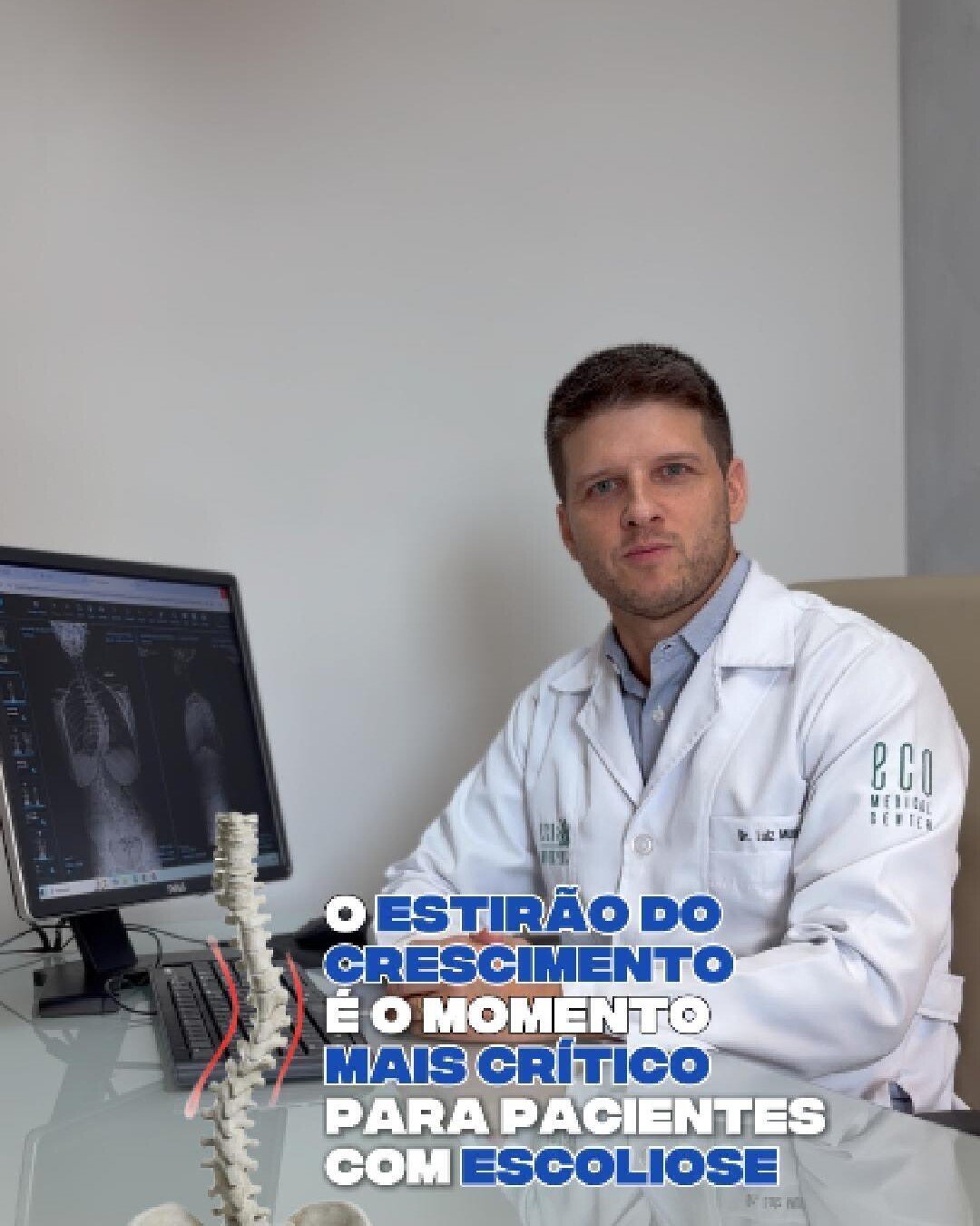 Dr. Luiz Müller Avila no consultório, ao lado de um modelo de coluna, com o texto: o estirão do crescimento é o momento mais crítico para pacientes com escoliose