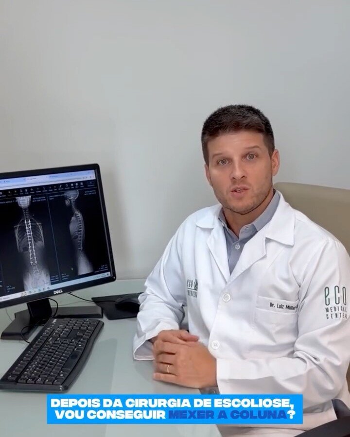 Dr. Luiz Müller Avila no consultório, ao lado de um exame de imagem da coluna, com o texto: depois da cirurgia de escoliose, vou conseguir mexer a coluna?