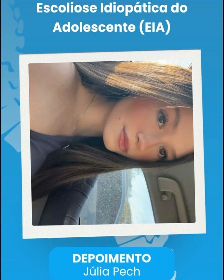 Foto da Júlia Pech, com o texto: escoliose idiopática do adolescente, depoimento