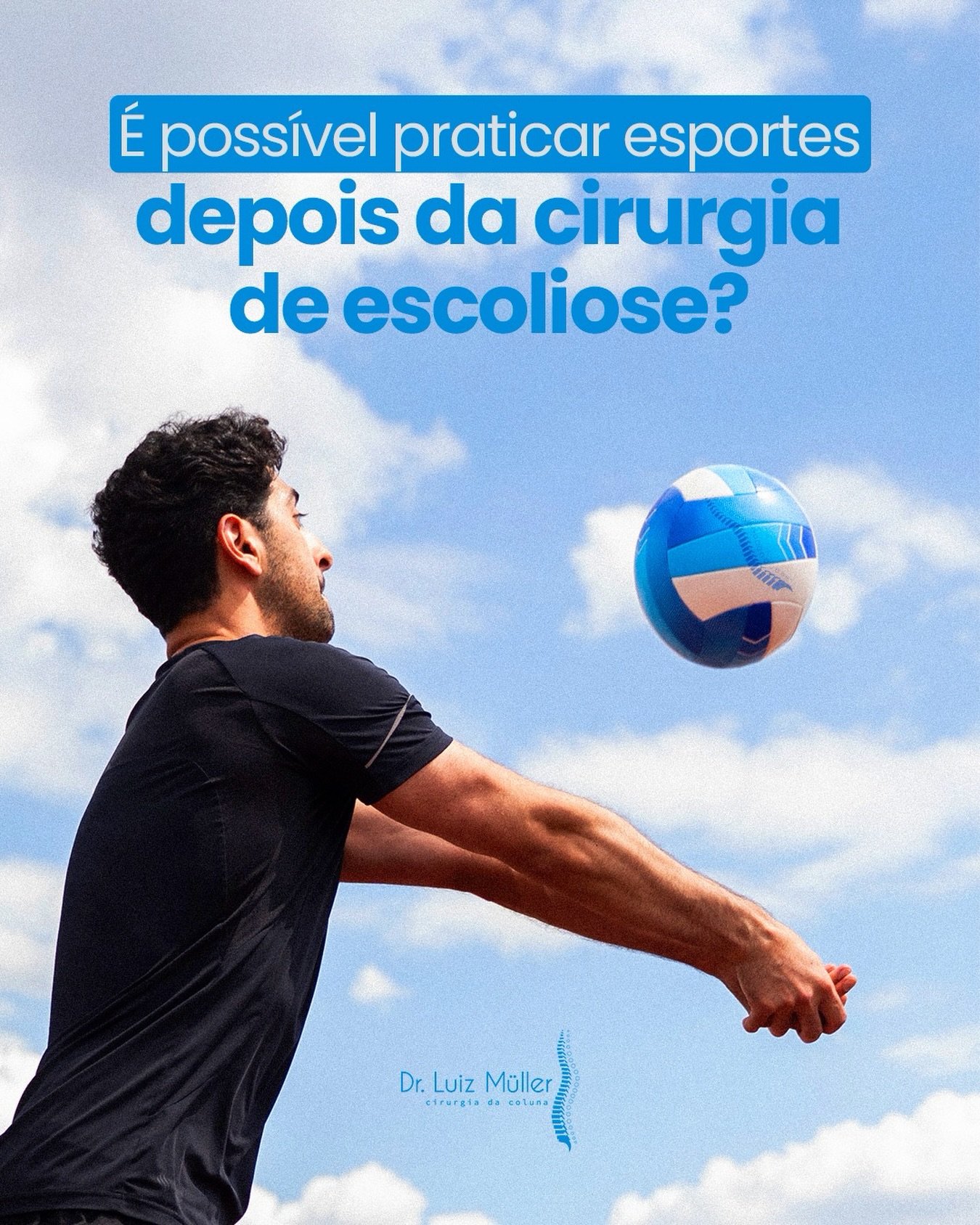 Jovem jogando vôlei ao ar livre, com o texto: é possível praticar esportes depois da cirurgia de escoliose?