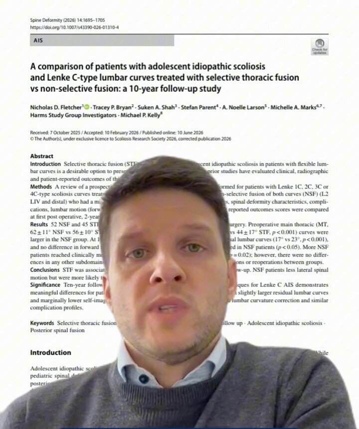 Dr. Luiz Müller Avila em vídeo, na frente do artigo científico publicado na Spine Deformity